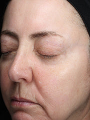 Image of face after using product